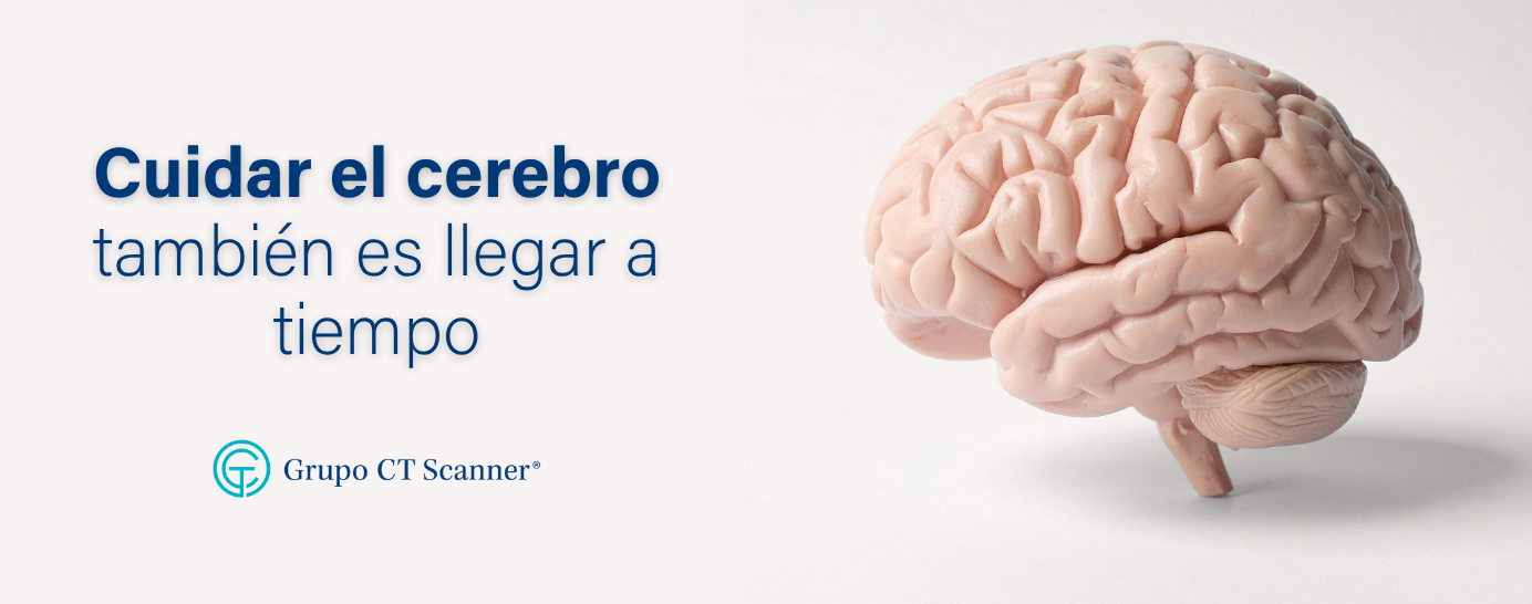 Blog_cerebro