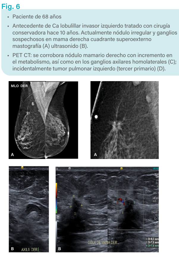 Figura 6. PET/CT y ultrasonido.