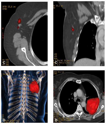 Imágenes PET/CT del caso clínico.